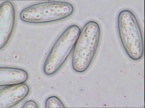 Image 4: Sarcoscypha coccinea spore5